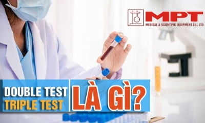 Double test và triple test là gì? Làm double hay triple test khi nào?