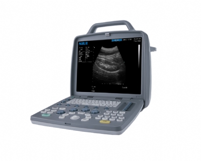 MÁY SIÊU ÂM 2D CTS - 6600