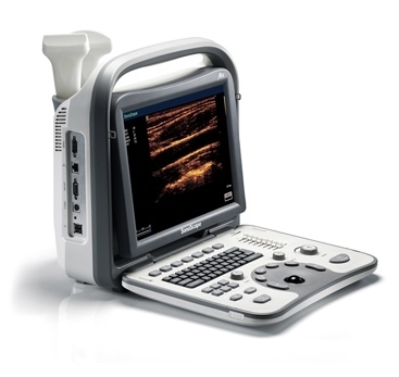 MÁY SIÊU ÂM XÁCH TAY SonoScape A5