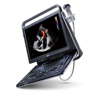 MÁY SIÊU ÂM XÁCH TAY CHISON EBIT60