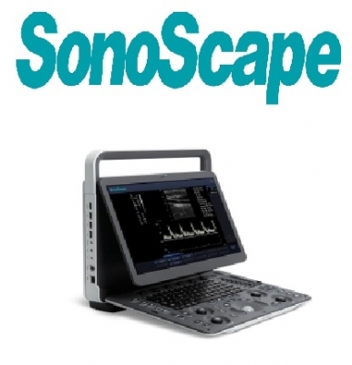 MÁY SIÊU ÂM XÁCH TAY E1-SONOSCAPE 