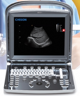 MÁY SIÊU ÂM PHỦ MÀU ECO1