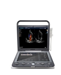 MÁY SIÊU ÂM XÁCH TAY CAO CẤP SonoScape S9