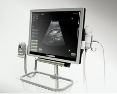 Máy siêu âm 2D màu ALBIT - tuyến tiền liệt và tiết niệu