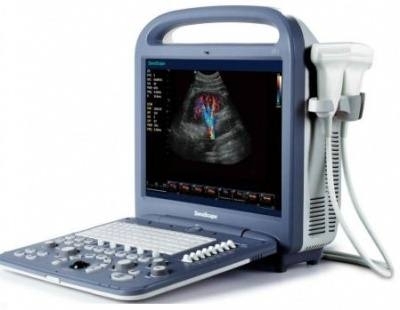 Máy siêu âm màu xách tay SonoScape S2