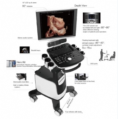MÁY SIÊU ÂM CHISON QBit 9