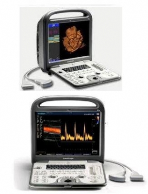 Máy siêu âm 3D Dopler màu S6