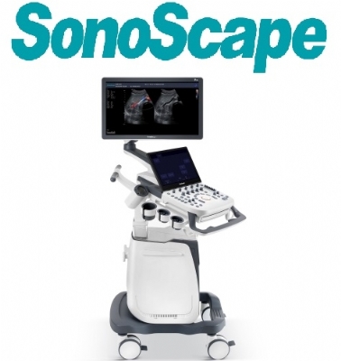 MÁY SIÊU ÂM MÀU 5D CAO CẤP P25 SonoScape